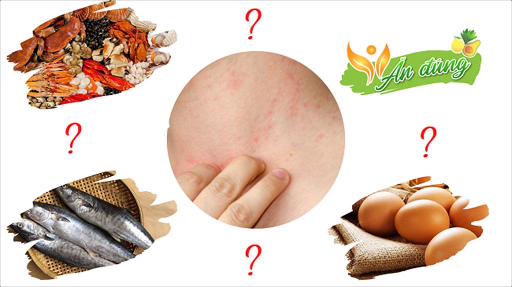 Mời tham dự khóa tập huấn: Xây dựng Văn hóa An toàn Thực phẩm và các biện pháp kiểm soát, ghi nhãn chất gây dị ứng trong sản phẩm thủy sản xuất khẩu